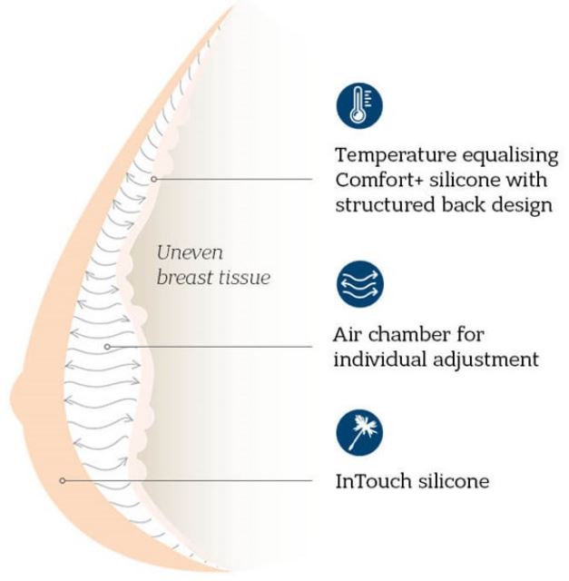 Balance Adapt Air Medium Delta 233 adjustable Breast Shaper Design