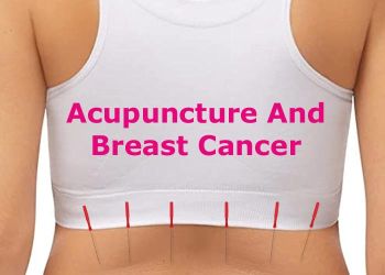 Acupuncture and Breast Cancer