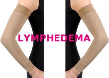 Lymphedema