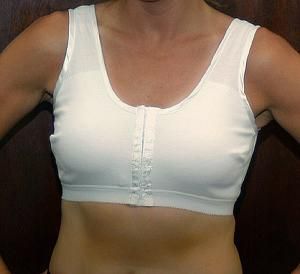 Style LEIS BRA/sale - Gentle Touch Mastectomy Leisure Bra - On Sale